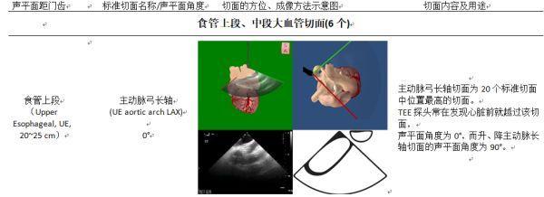 指南与共识围手术期经食管超声心动图监测操作的专家共识一