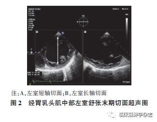 经食管超声心动图在非心脏手术中应用专家共识 (2020版)|超声心动图