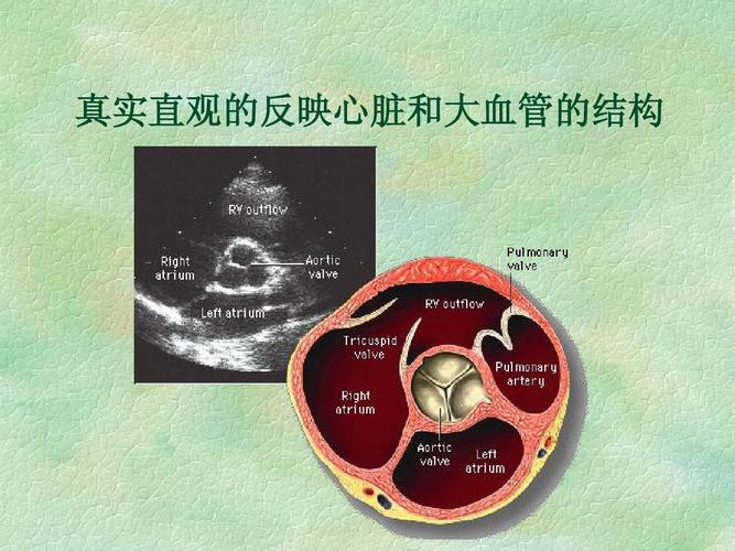 超声心动图在先天性心脏病诊疗中的应用