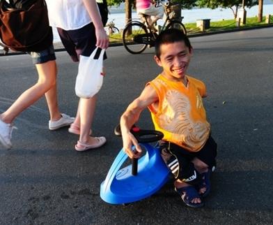 幼儿保健 正文    小儿麻痹症后遗症一般发病与5岁以下的儿童,造成