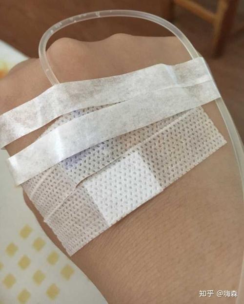 有没有输液的照片,我给老师请的病假,她要我发照片给她?